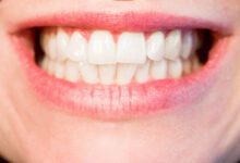 2 Tips to take better care of your gums